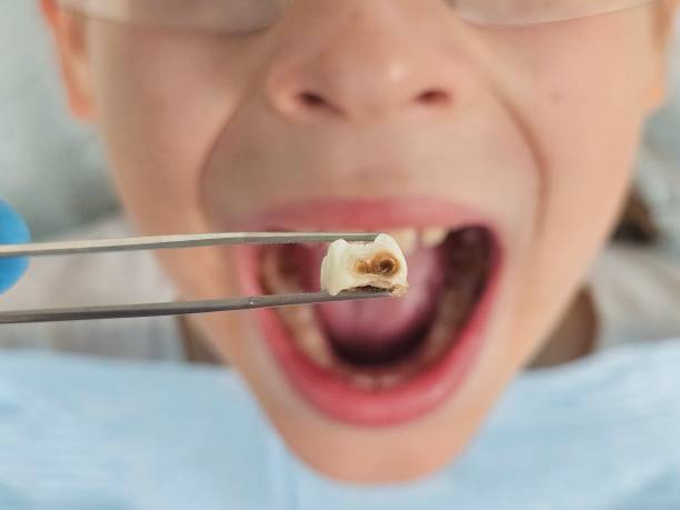 Best Broken or Chipped Tooth Repair in Mont Alto, PA